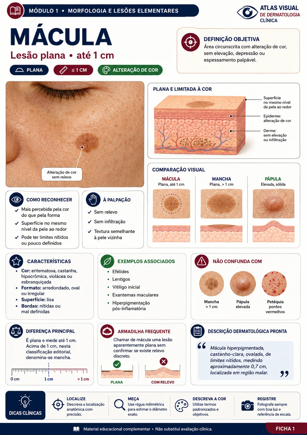 Ficha visual de dermatologia sobre mácula