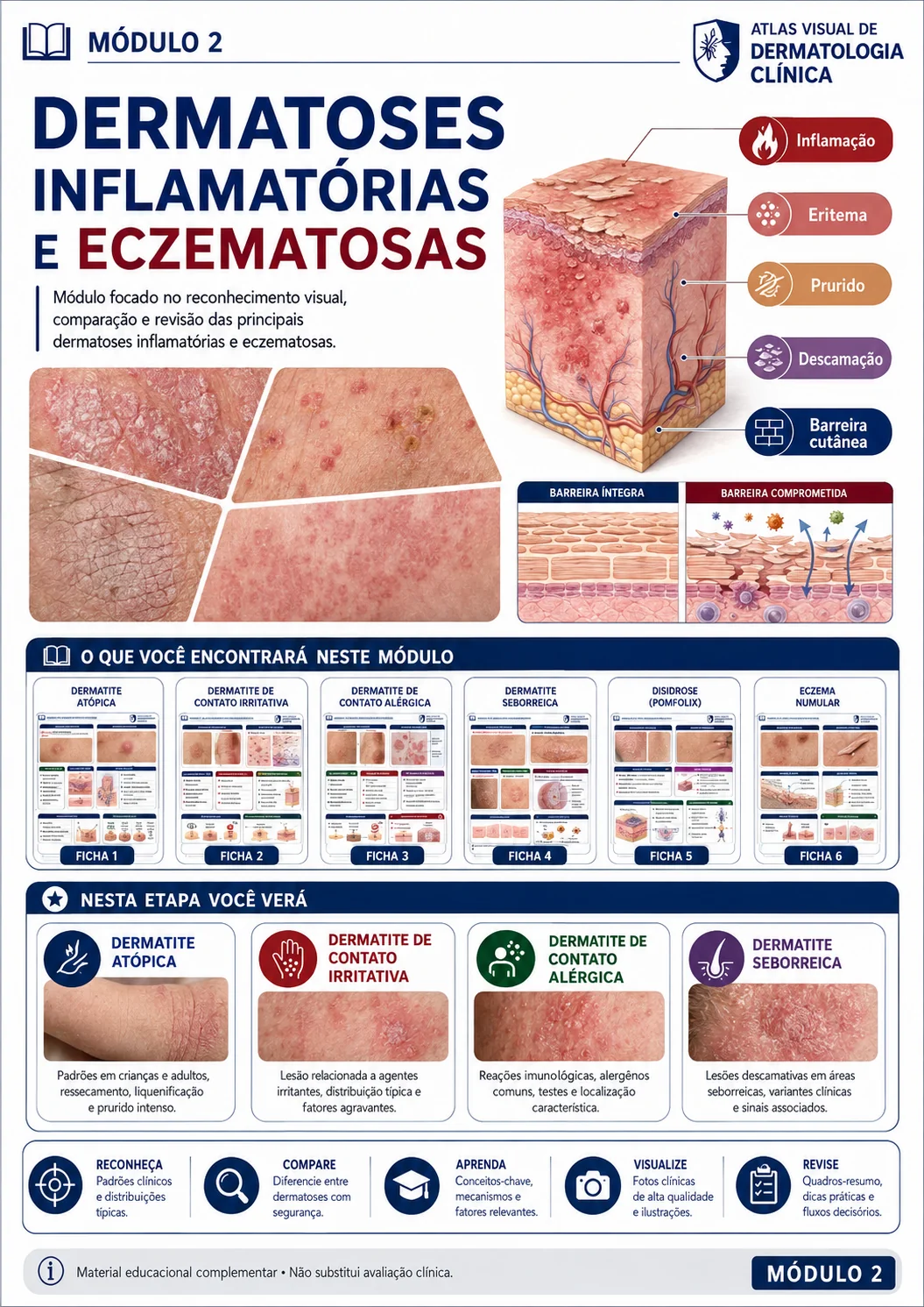 Abertura visual do módulo de dermatoses inflamatórias e eczematosas