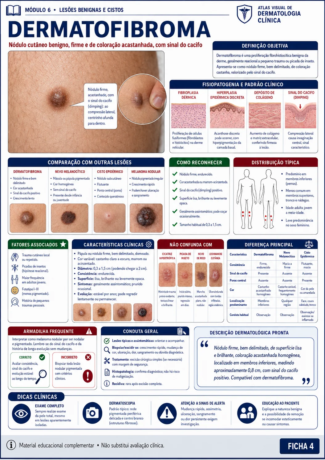 Ficha visual de dermatologia sobre dermatofibroma