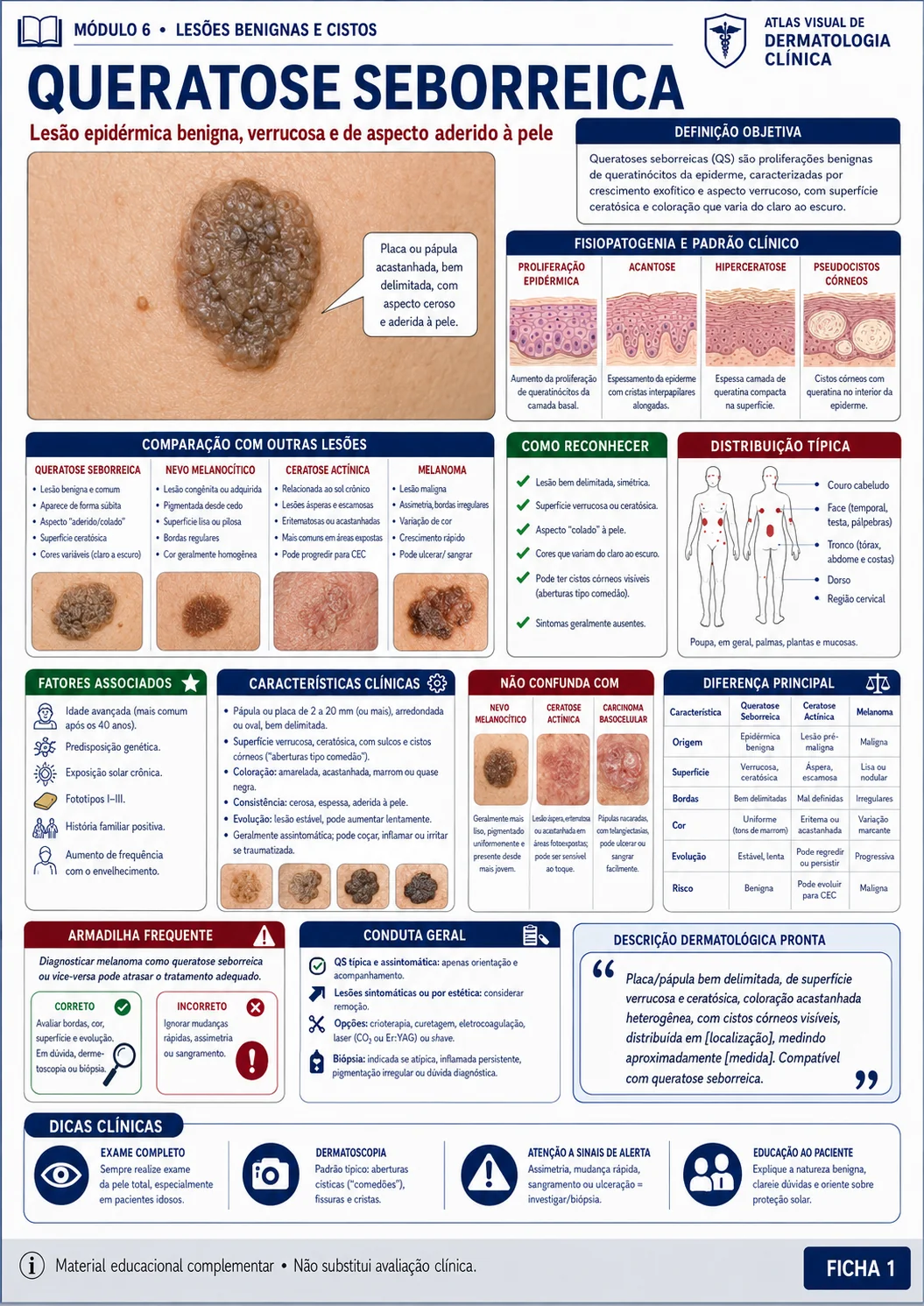 Ficha visual de dermatologia sobre queratose seborreica